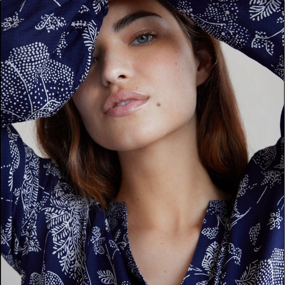 Anthropologie | ELYN TUNIC DRESS | Size XS - Picture 4 of 7